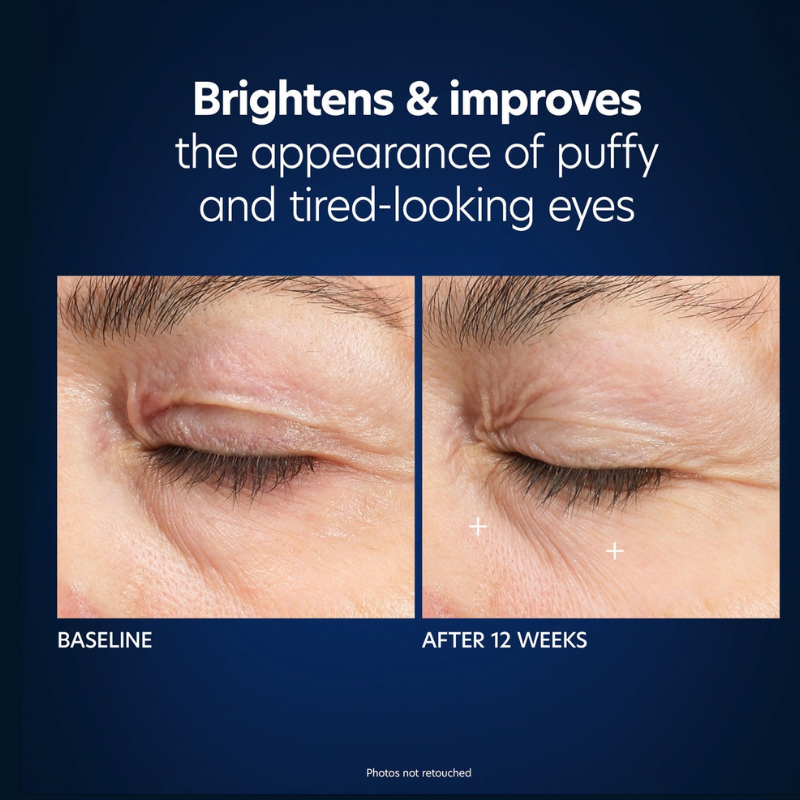 Hyaluronic Acid Microneedle Eye Patches