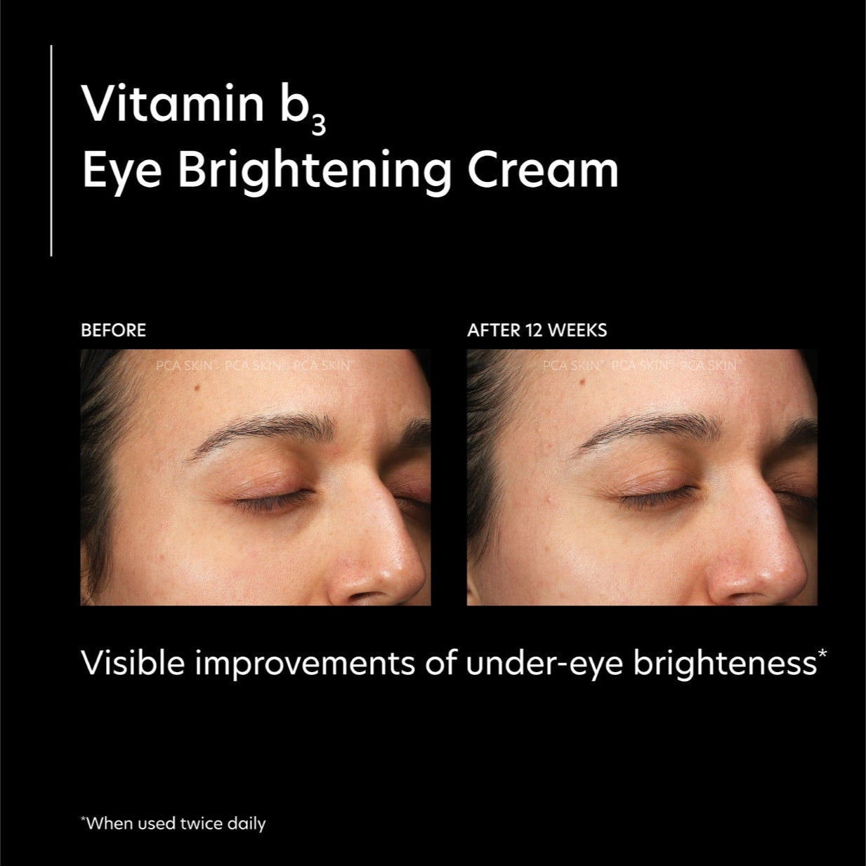Vitamin B3 Eye Brightening Cream