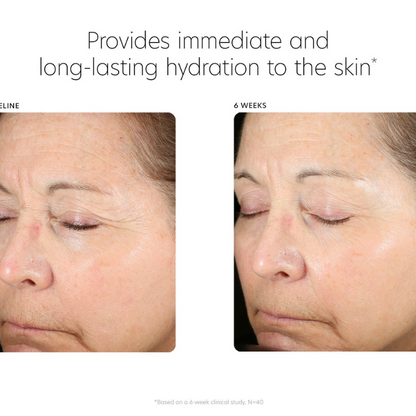 Hyaluronic Acid Boosting Serum