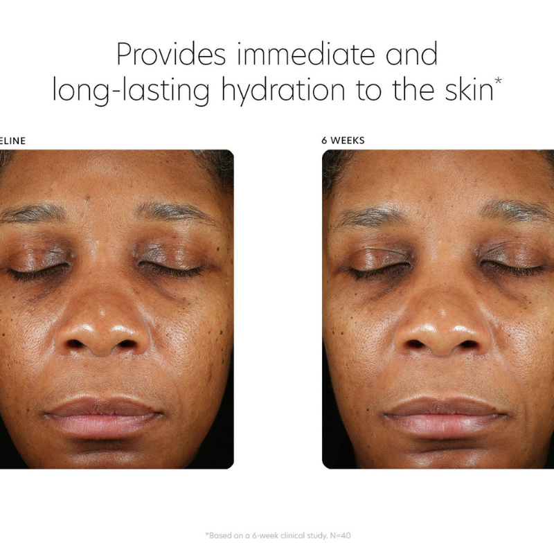 Hyaluronic Acid Boosting Serum