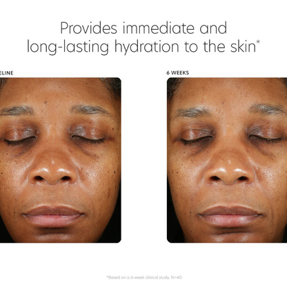 Hyaluronic Acid Boosting Serum