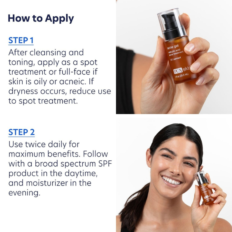 Acne Gel